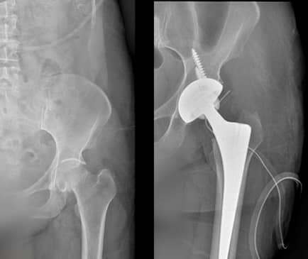 Slider image (2) Dr. Metztli Linette Gomez Espinoza - Orthopedic Clinic